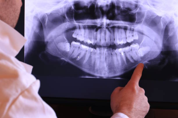Best Emergency Denture Repair in Kingsland, GA